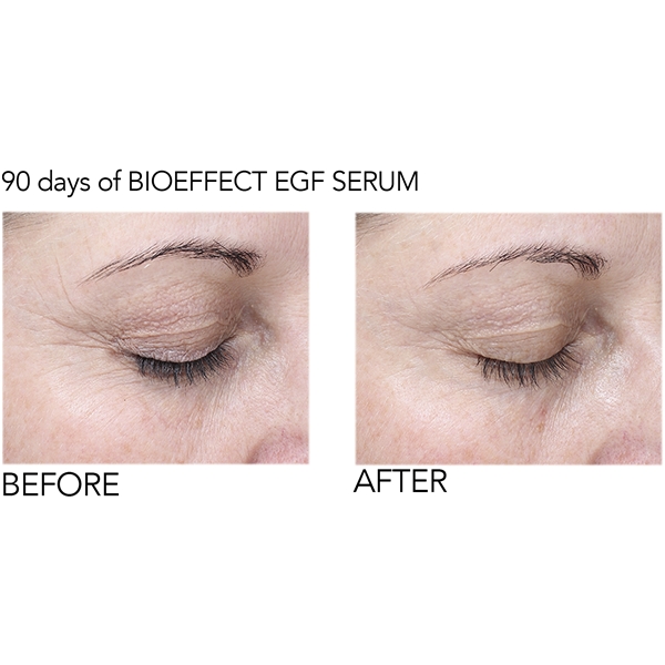 BioEffect EGF Eye Serum (Kuva 6 tuotteesta 10)