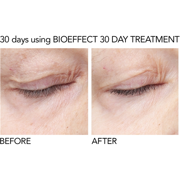 BioEffect EGF Eye Serum (Kuva 4 tuotteesta 10)