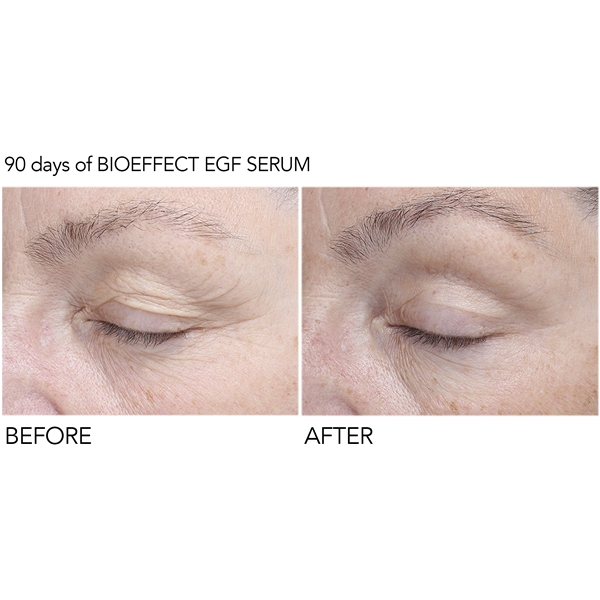 BioEffect EGF Eye Serum (Kuva 5 tuotteesta 10)