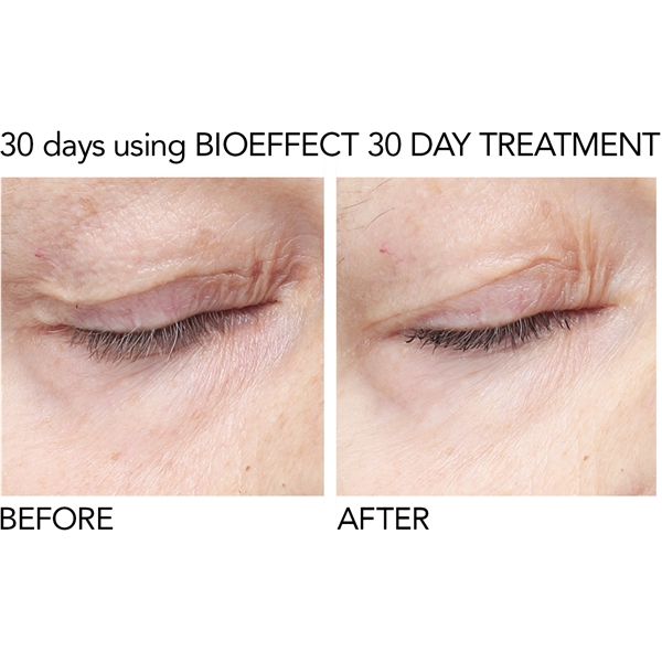 BioEffect 30 Day Treatment (Kuva 4 tuotteesta 8)