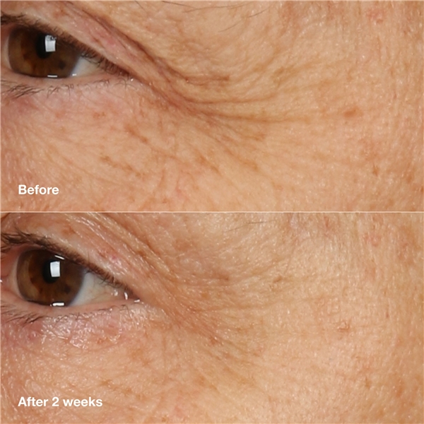 Smart Clinical Repair Overnight Cream + Mask (Kuva 3 tuotteesta 10)