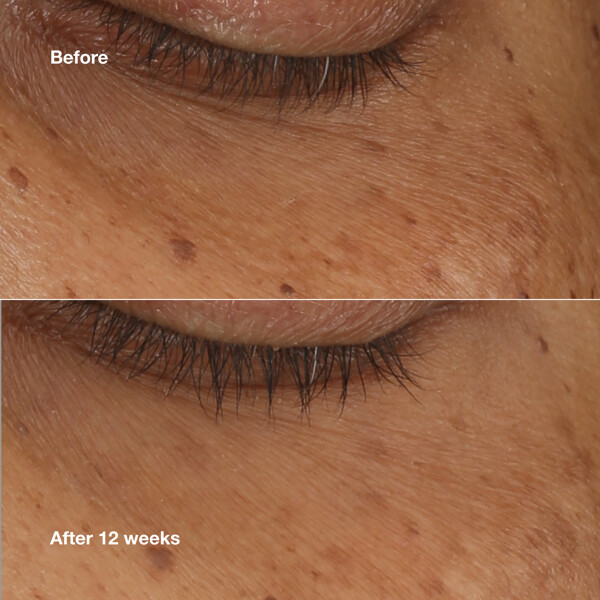 All About Eyes Brightening Serum Concentrate (Kuva 2 tuotteesta 10)