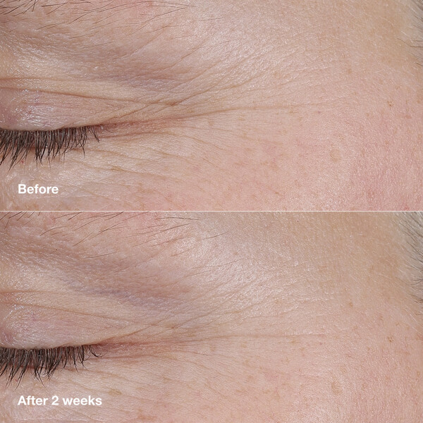 Smart Clinical Repair AM/PM Retinoid Balm (Kuva 5 tuotteesta 8)