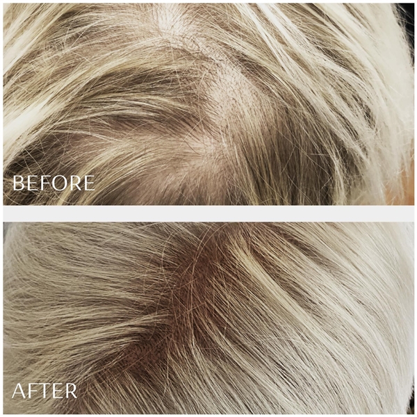 M2 Beauté Hair Activating Serum (Kuva 2 tuotteesta 5)