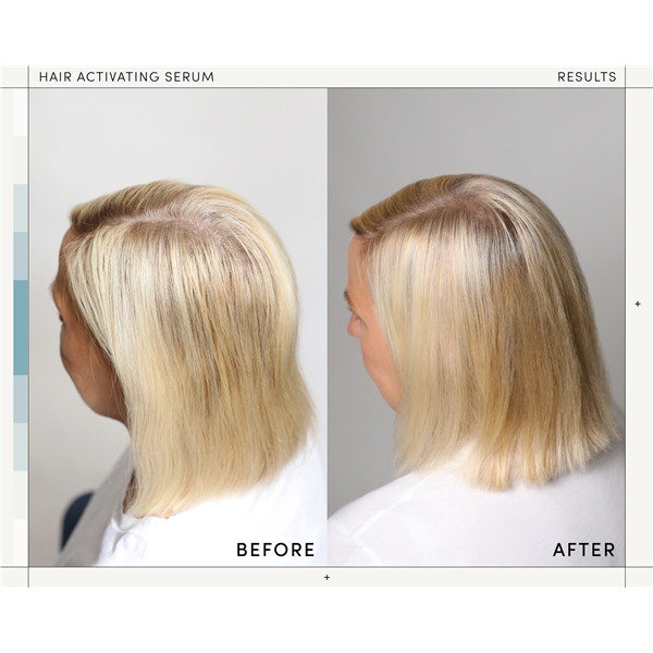 M2 Beauté Hair Activating Serum (Kuva 4 tuotteesta 5)