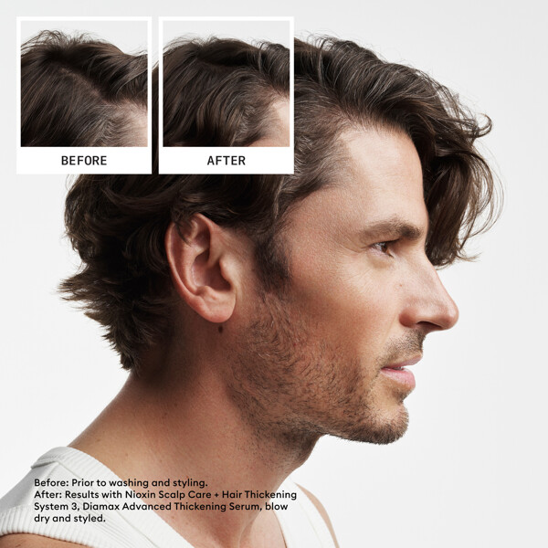 Hair System Kit 2 (Kuva 2 tuotteesta 6)