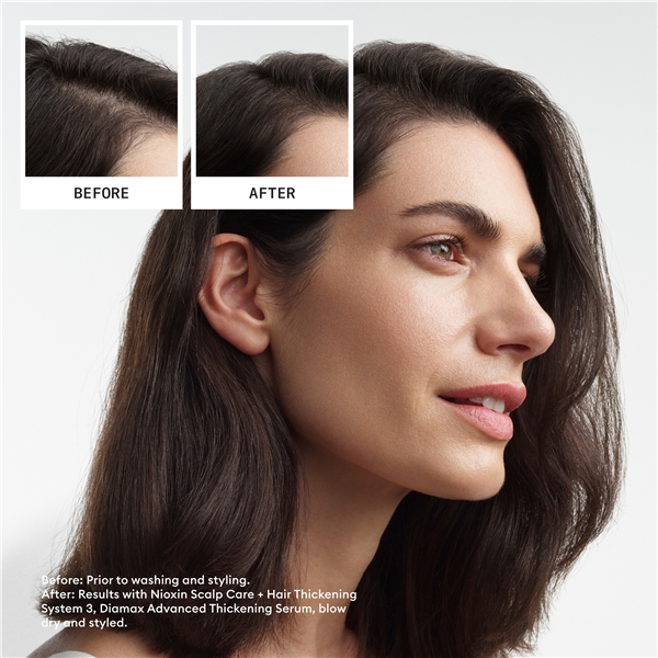 Hair System Kit 3 (Kuva 2 tuotteesta 6)