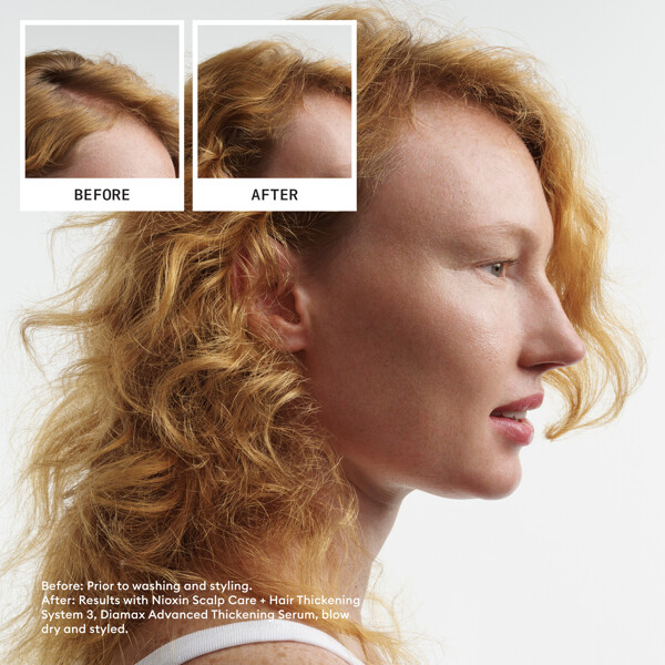 Hair System Kit 4 (Kuva 2 tuotteesta 6)