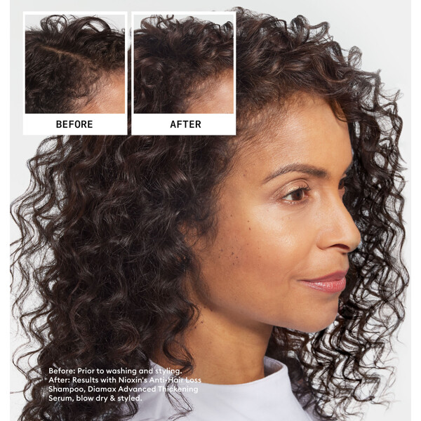 Nioxin Anti Hair Loss Shampoo (Kuva 2 tuotteesta 6)