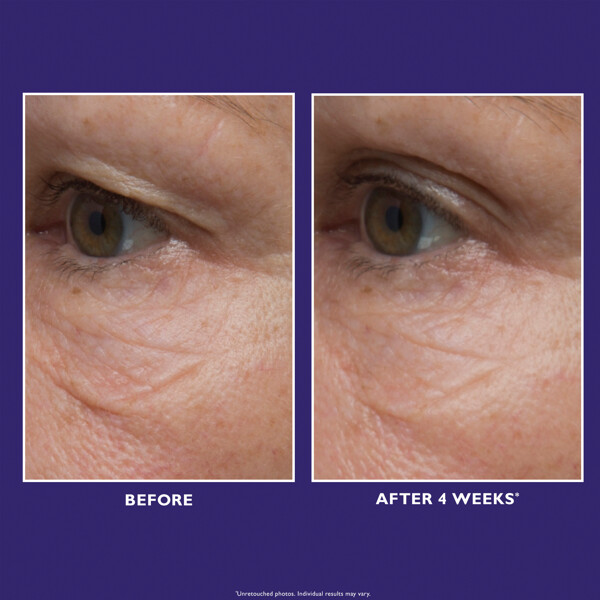 Ultimate Solution 5™ Eye Cream (Kuva 4 tuotteesta 8)