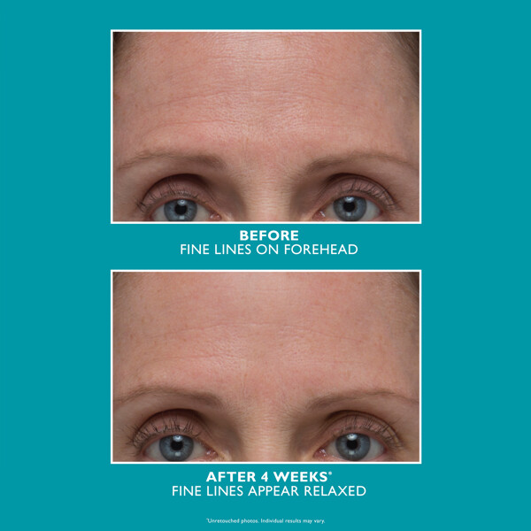 Peptide Skinjection Amplified Wrinkle Fix Serum (Kuva 3 tuotteesta 3)