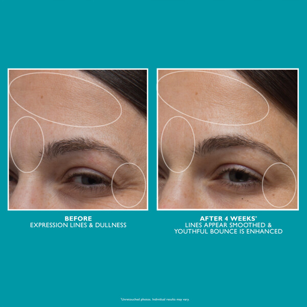 Peptide Skinjection Moisture Infusion Cream (Kuva 3 tuotteesta 3)